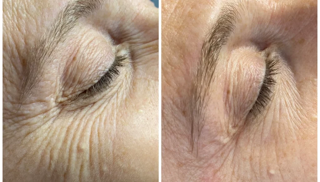 K Beauty SPOT - B-A - Nega obraza