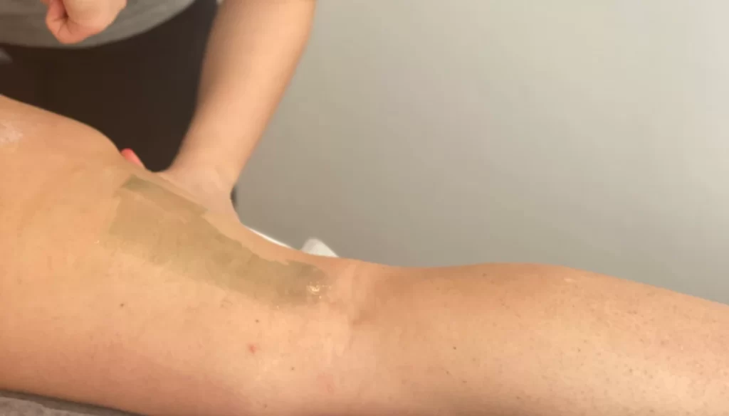 K Beauty SPOT - B-A - depilacija 1