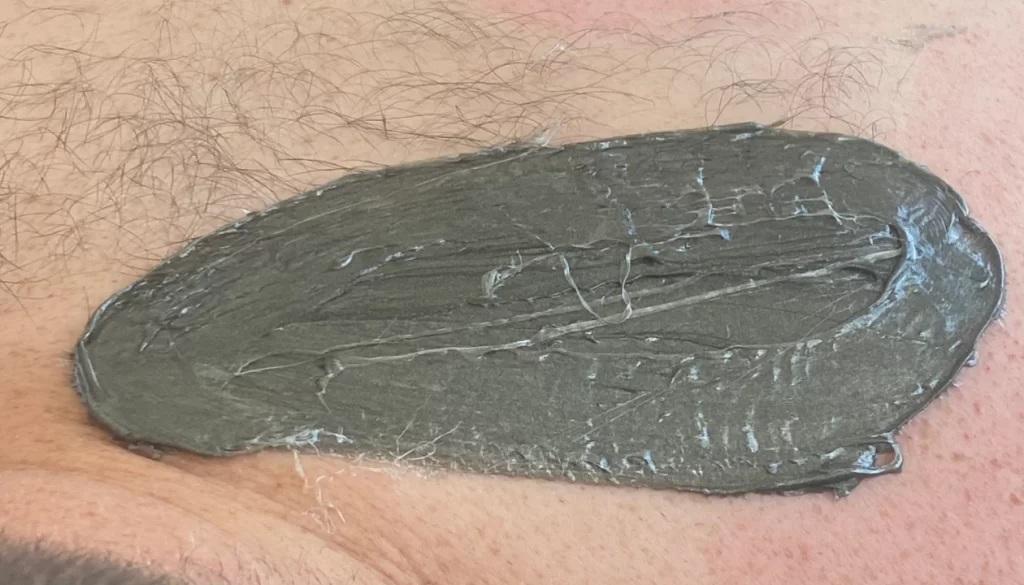 K Beauty Spot B A Depilacija 4