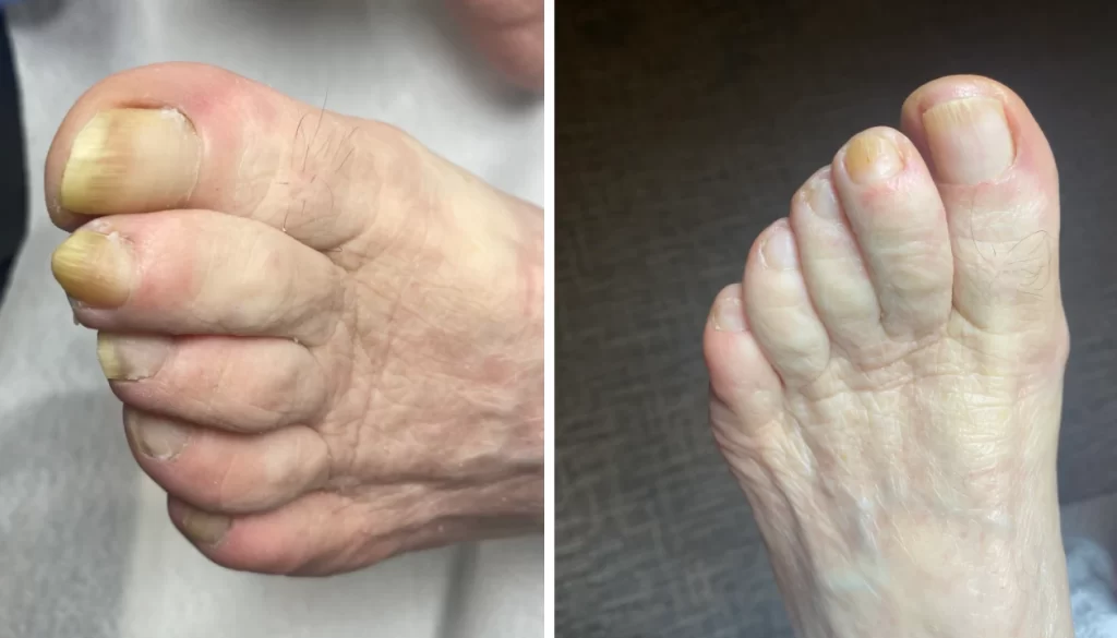 K Beauty SPOT - medicinska pedikura 1