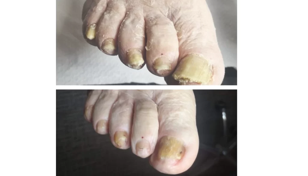 K Beauty SPOT - medicinska pedikura